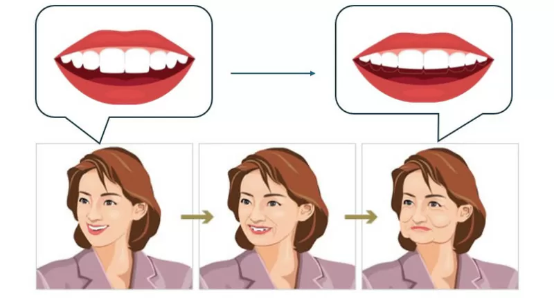 どうして歯科医院でヒアルロン酸？